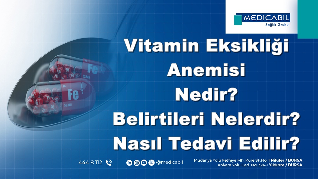 Vitamin Eksikliği Anemisi Nedir? Belirtileri Nelerdir? Nasıl Tedavi Edilir?